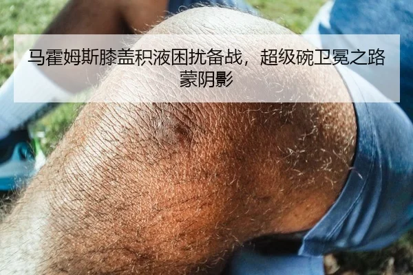 马霍姆斯膝盖积液困扰备战，超级碗卫冕之路蒙阴影